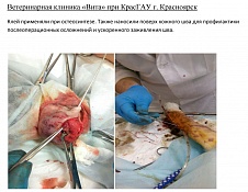 Остеосинтез.